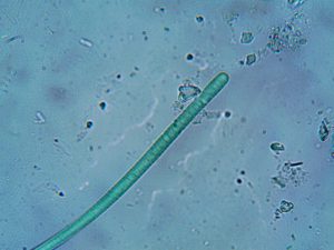 nematode