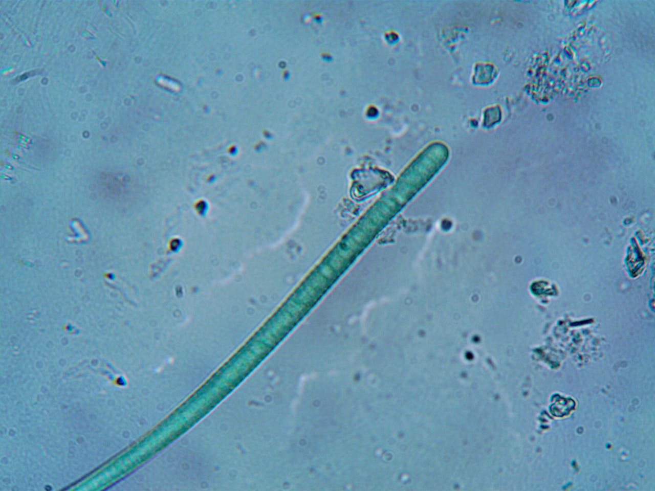 Use of onion crop residues and solarheating to control nematodes
